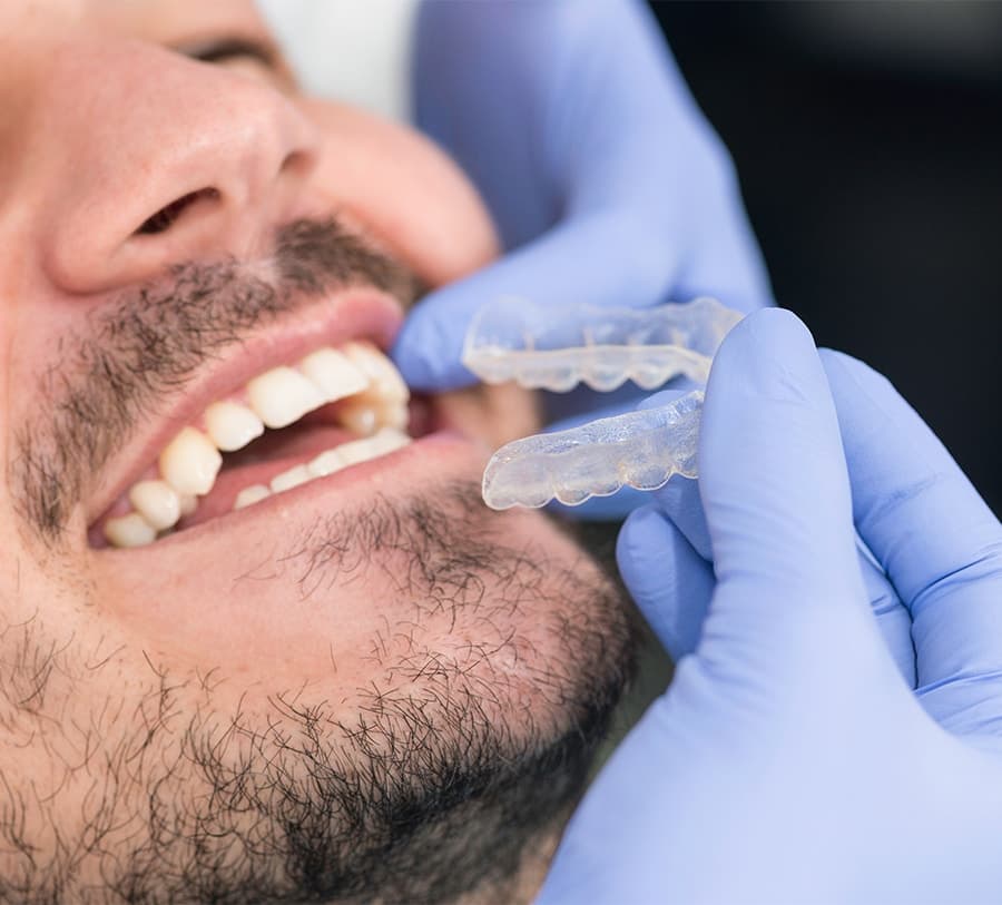 Adult patient with Invisalign clear aligners
